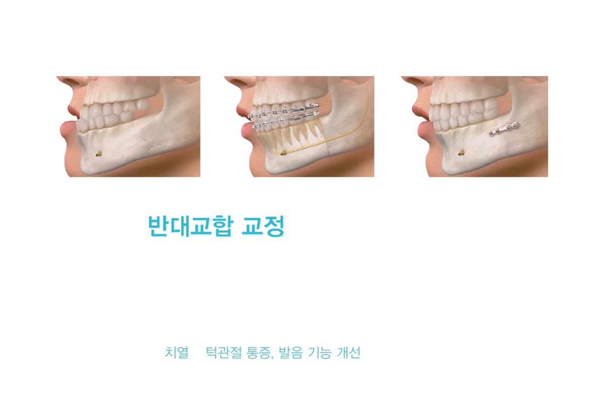 Ÿġ ݴ뱳 